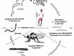 Life Cycle of Onchocerca Volvulos